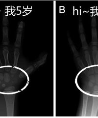 ��̽���츾�ױ���Ժ������ڷ��ڿ�ӭ������߷�