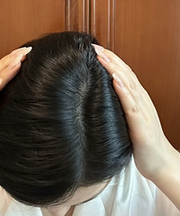 脱发到底要怎么补充维生素?我来根据自身经验,做个大汇总