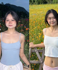 瘦脸针三个月了,现在完全无法接受打之前的自己了!