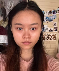 瘦脸针三个月了,现在完全无法接受之前的自己了
