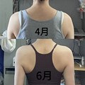 靠墙站2个月的对比