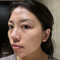 刷酸后皮肤变得好光滑