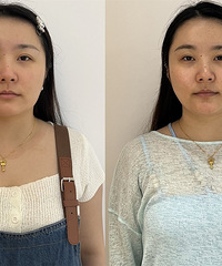 方圆脸想要瘦脸成功,这个方法可以试试