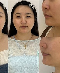 方圆脸想要瘦脸成功,这个方法可以试试