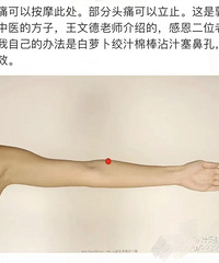 这个方法缓解偏头痛很有效!真的好神奇