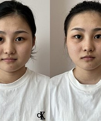 做黑金超光子后肤色就亮了,还好便宜呀