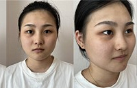 58元做黑金DPL超光子+小气泡,太划算了