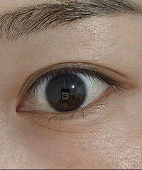 眼纹真的很显老!都来说说好方法吧,有些真的立竿见影