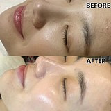 坚持光子和水光真有用