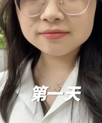 瘦脸之后,16天变化好大!感觉我的脸变小了一整圈,才花699