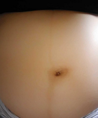 [����]���ڷ��ֶ������߲��Գƣ�һ�ߴ�һ��С����Ҫ���ڵ���