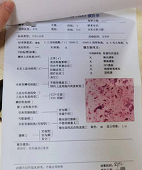 [����]����ͬ�б���һ�룬159�㶨HPV+TCT+����ɸ��