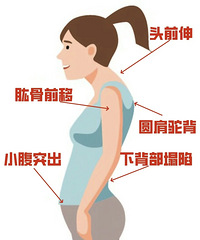有很严重的体态问题!是应该去医院康复科还是健身房呢