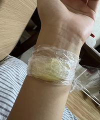 分享一个自用小土方,缓解胃胀气真的有效!做法也很简单