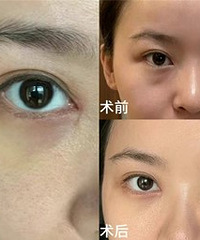 �������۴������濴�����κκۼ���