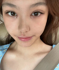 暑假太适合做双眼皮了,价格便宜,也更适合恢复