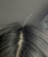 90后的朋友们,你们有白头发了吗?怎么缓解白发焦虑的呀