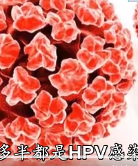 ŮƵףһ龹ȾHPV