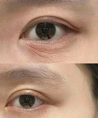 被林允种草的胶原水光,对付眼周抗衰,效果真的好明显