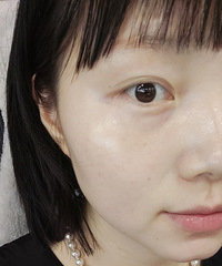 坚持做水光真的有用吗?看看我的皮肤变化,逢人就会被夸