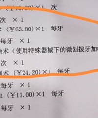 拔过智齿的友友们,这个收费正常吗