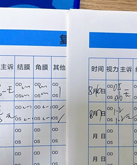 带双胞胎到重庆做近视手术,第二天就恢复到了裸眼1.5