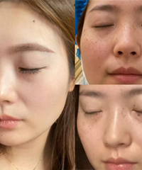 ��߰���º�Ƥ���׾���һ��û����