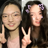 近视手术也能让人变美