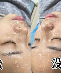 谁能想到!效果这么好的黑金超光子,只要58元