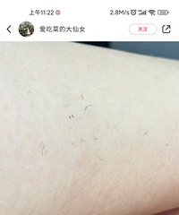 42�ȵ����쵽���ж��ȣ����˵ĺ�ë������