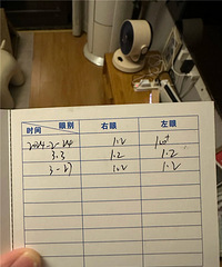 800多的高度近视,找了重庆有名的眼科医生做手术才放心
