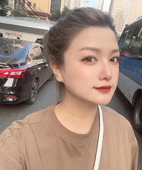 做了双眼皮修复之后,我的眼睛又变得很漂亮了!关键还超自然