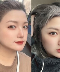 我现在的双眼皮,真的超级自然