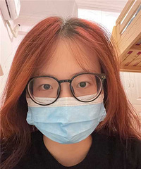 1300度还加200度散光,也能做近视手术!现在恢复到1.0