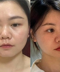 ��˥5�꣬�����ұ�������