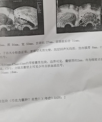 [����]ͻ������ȥ��죬��������ף�����������Ҫһ����