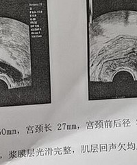 ���ף�ҽ��˵��Ҫ��������������1-2��