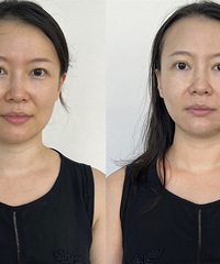 做一次超光子+水光+牛奶光,才199元!这种大羊毛,我先薅了