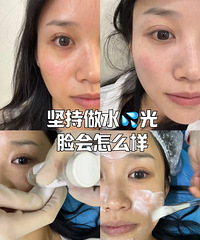 坚持打水光2年,皮肤变化太直观!不再花冤枉钱买贵价护肤品了