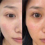 坚持打水光2年的皮肤