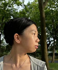 下巴后缩真的太丑了,只用了2支玻尿酸,现在变成了大甜妹