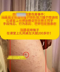 “女生被同桌扎218针”,未达到校园霸凌标准?