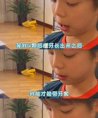 嗯哼终于戴上牙套了