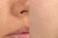 Сë׻ƽ΢1380  ۴980 ˫Ƥ2999