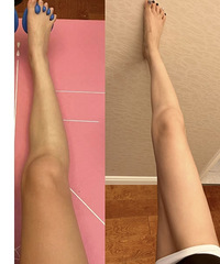小腿粗姐妹想要腿变直,就练这一个部位!现在又细又直又好看