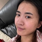 皮肤太干了就去做水光