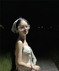 高度近视没有选很贵的ICL,而是选了这种激光手术,恢复也很棒