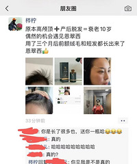 脂溢性脱发七八年,没想到用了这个方法,还能重新长回新头发