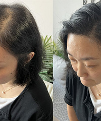 一步实现“换头”!3小时轻松改变,宽发缝就这么没了?!