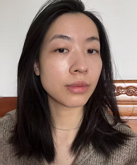 个人觉得填充泪沟,除了烧钱没有任何缺点了